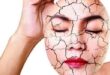 Tips Perawatan Kulit Wajah Kering Menjadi Halus Mulus
