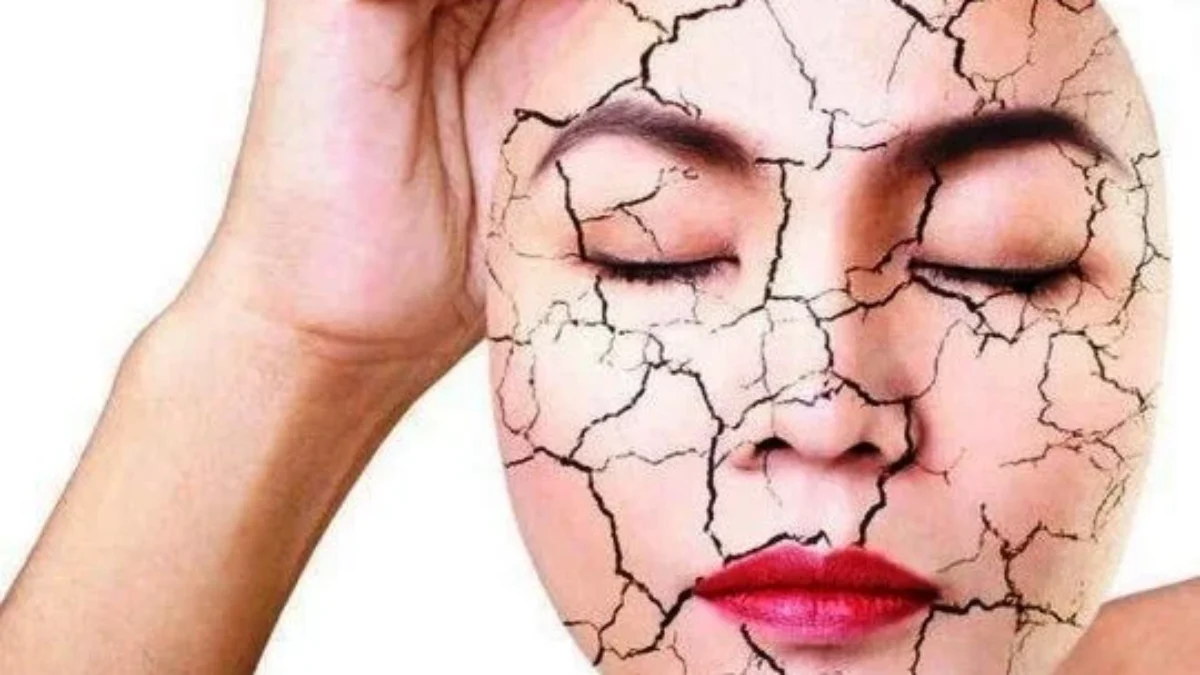 Perawatan untuk Kulit Wajah Kering agar Halus, Mulus dan Kencang