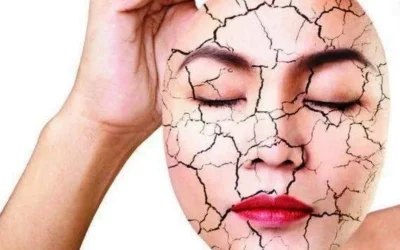 Perawatan untuk Kulit Wajah Kering agar Halus, Mulus dan Kencang