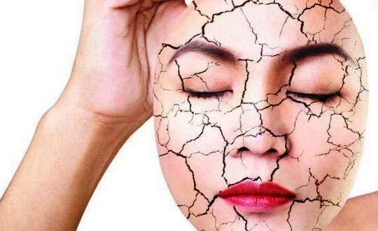 Tips Perawatan Kulit Wajah Kering Menjadi Halus Mulus