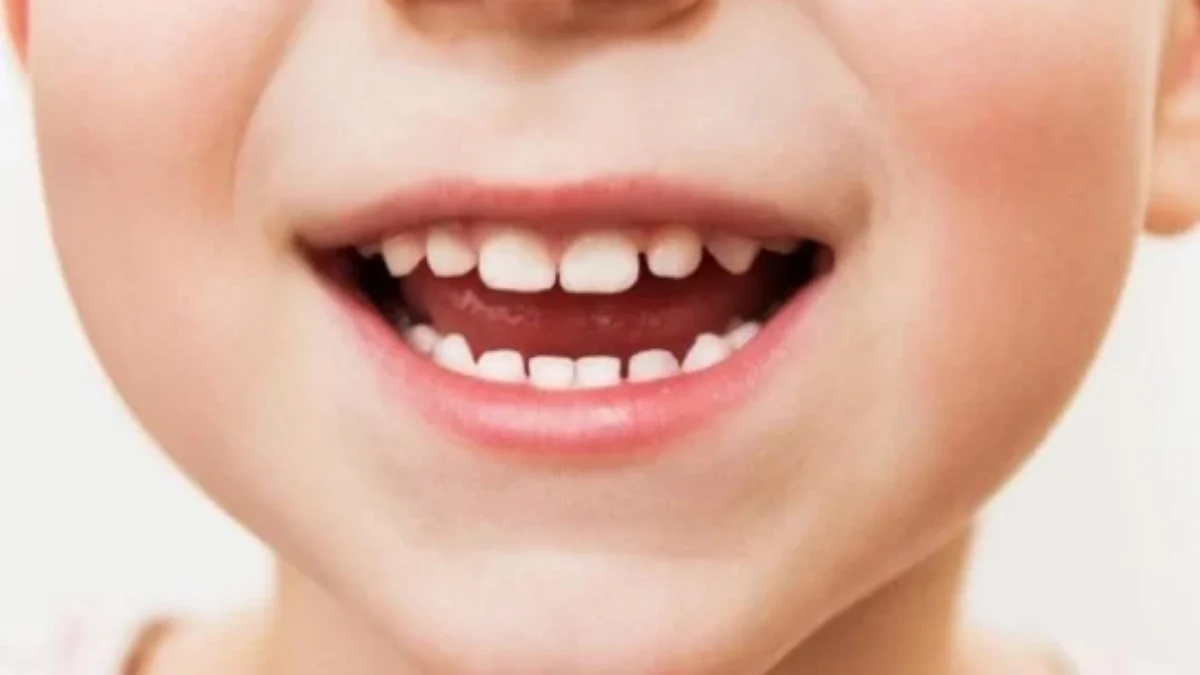 6 Tips Merawat Gigi Anak yang Baru Tumbuh agar Sehat Selalu