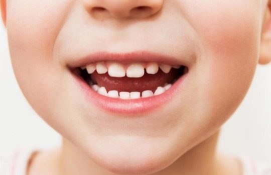6 Tips Merawat Gigi Anak yang Baru Tumbuh agar Sehat Selalu